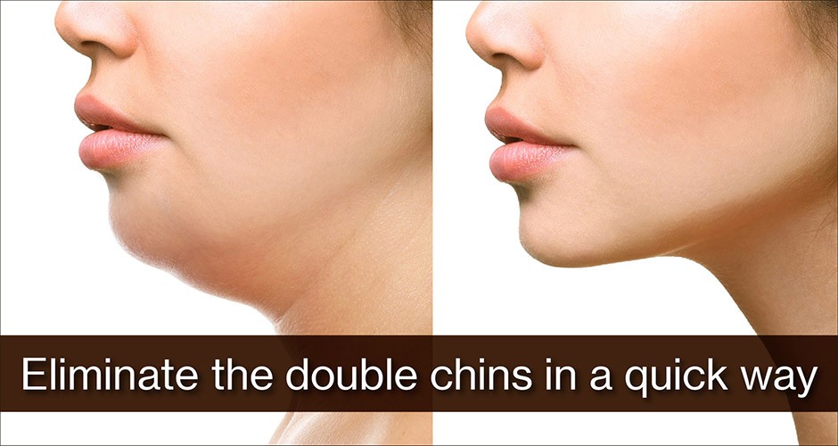 Eliminate the double chins in a quick way